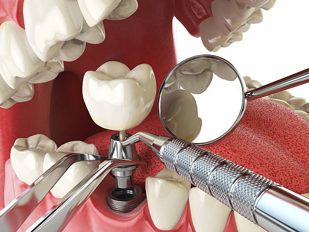 Best Urgent Tooth Repair  in Surfside Beach, SC
